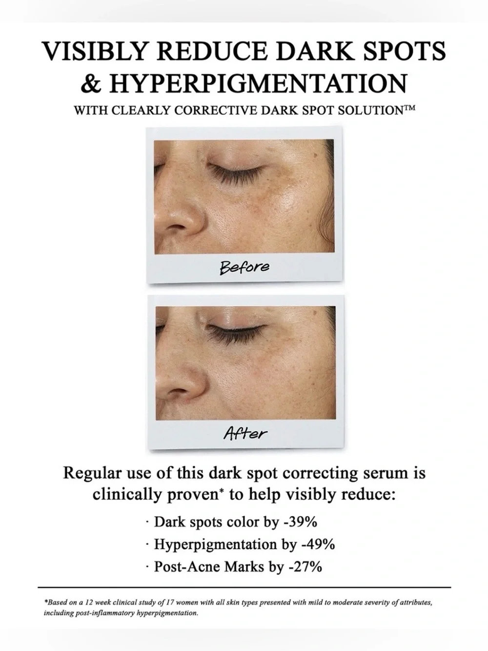Kiehl's Clearly Corrective Dark Spot Solution 1.0oz / 30ml (New in Box)